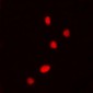 Anti-DDX5 (pY593) Antibody